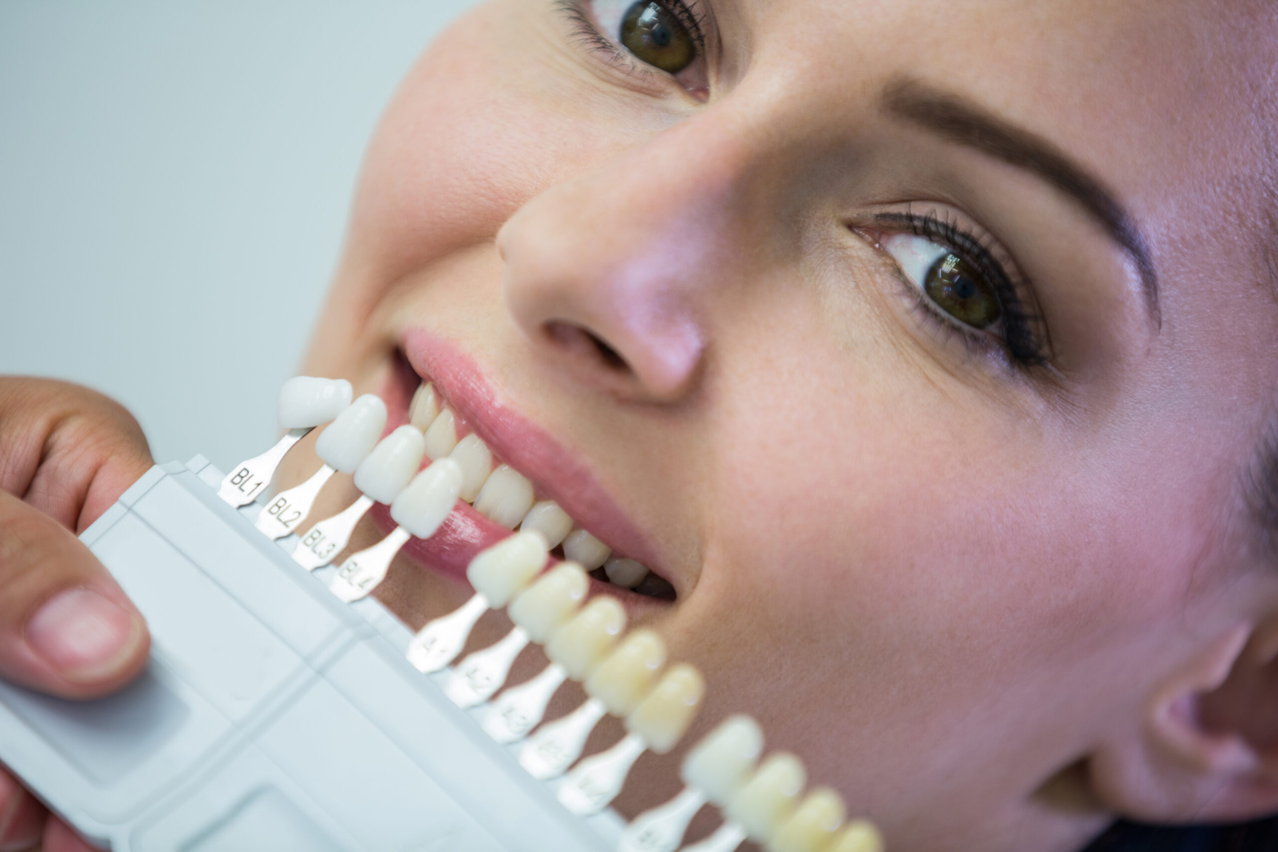 Dentista examinando uma paciente que usará facetas de resina.