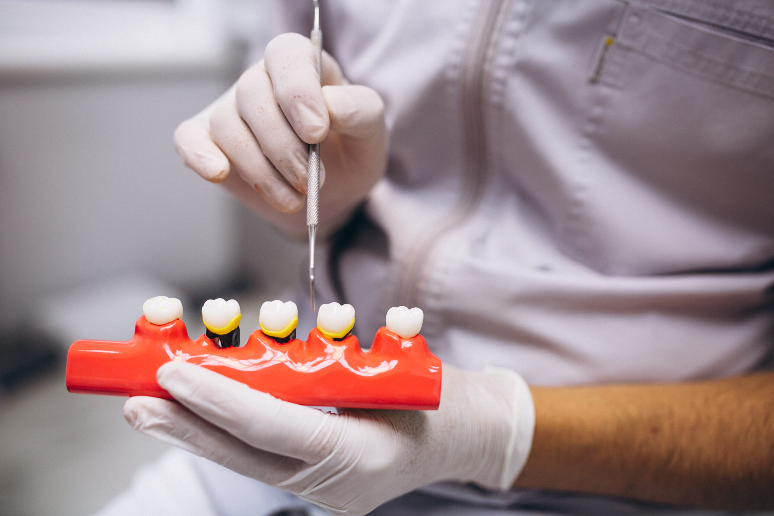 Dentista mostrando uma maquete de dentes danificados, para exemplificar os tipos de restauração de dente.