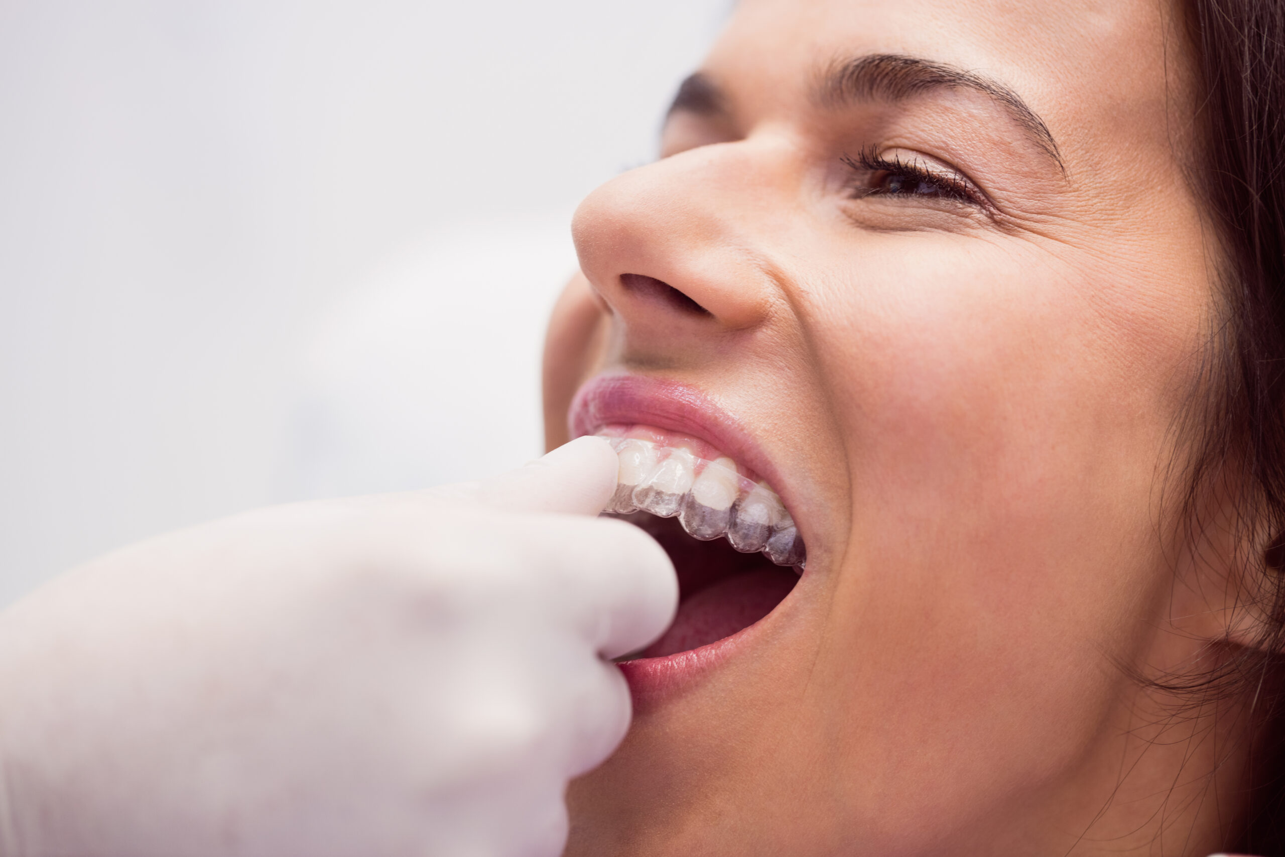 Paciente usando contenção ortodôntica, colocada por seu dentista.