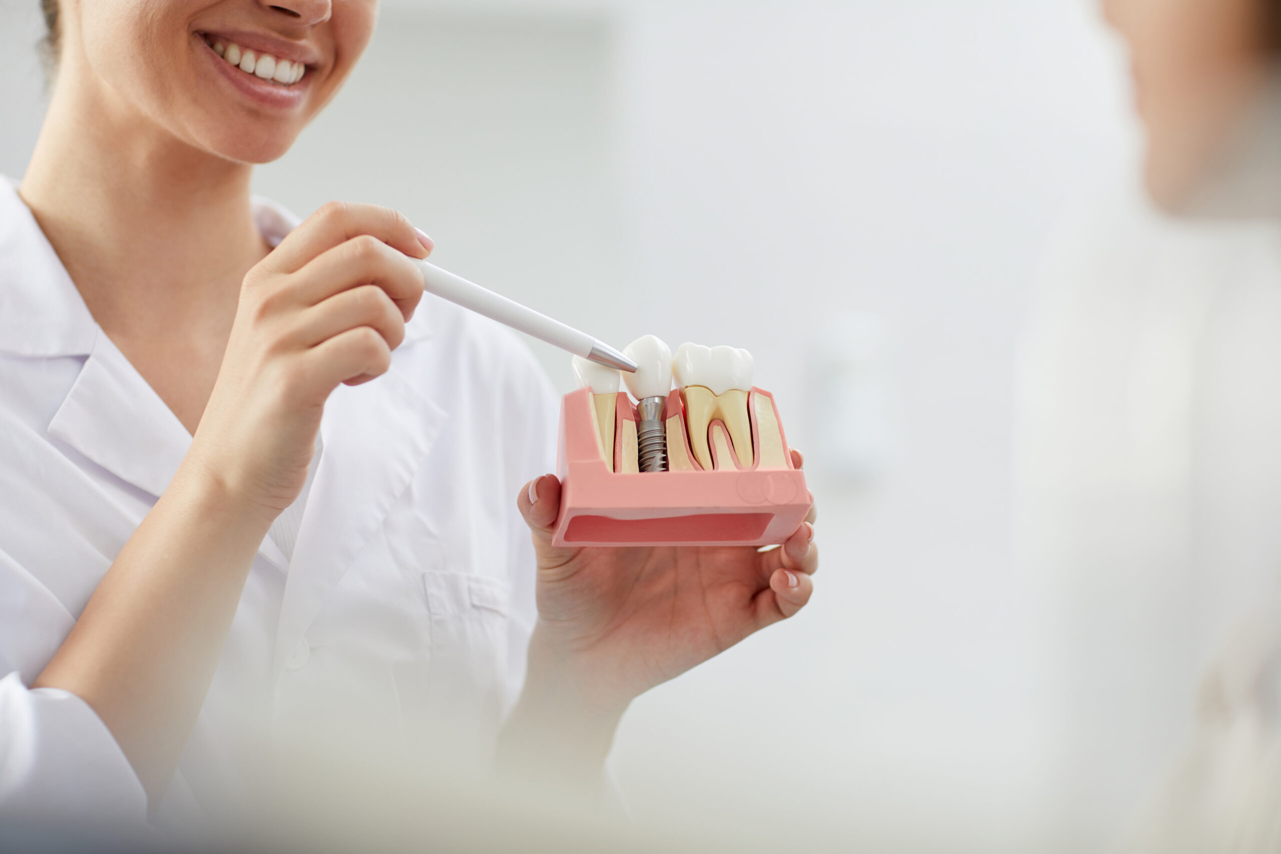 Dentista mostrando um exemplo de implante dentário para seu paciente.