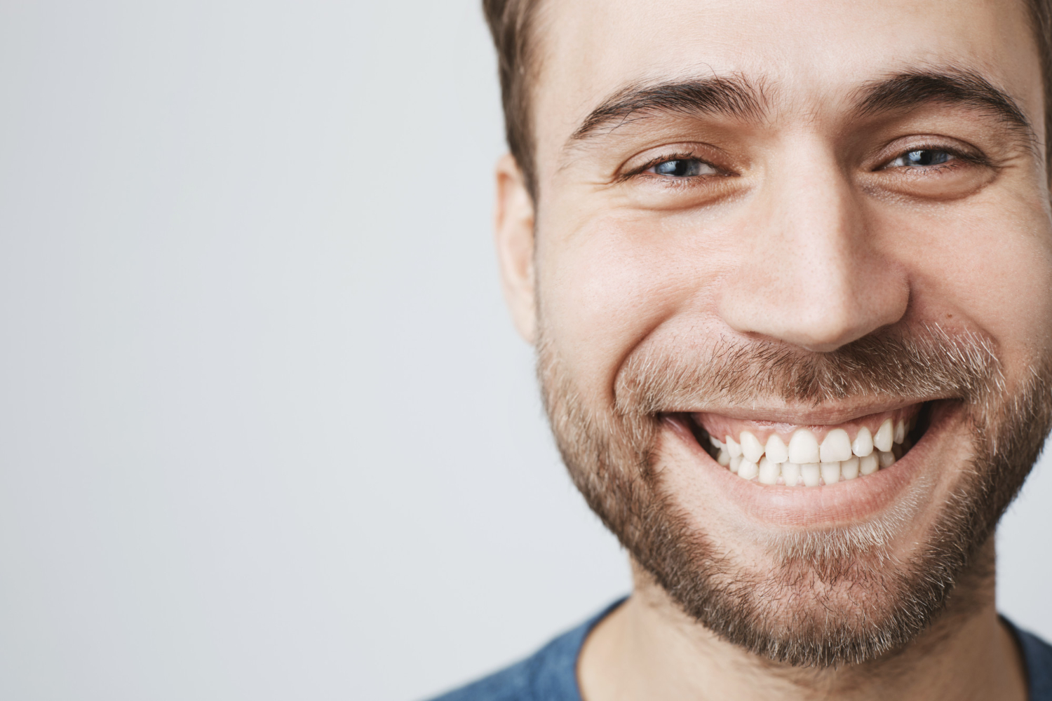 Homem sorridente exibindo seu sorriso gengival.